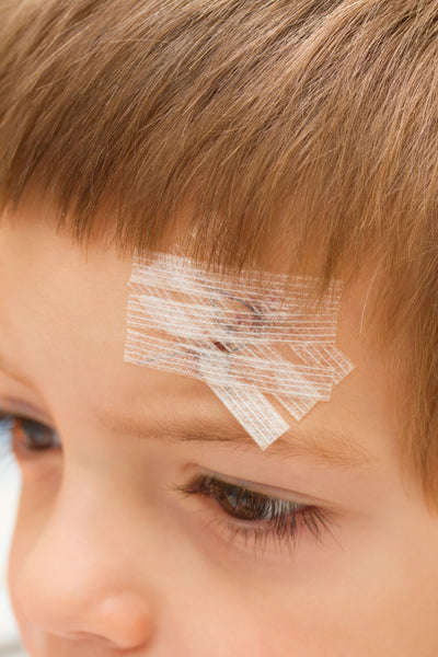 Skin Primary Closure Closure Wound Skin Closures, Reinforced – Endure Industries